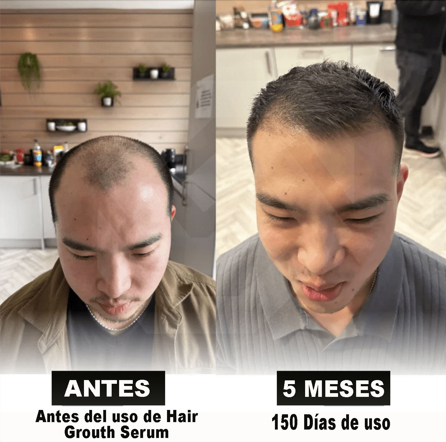 EL PRODUCTO QUE MILES DE PERSONAS USAN PARA CUIDAR SU CABELLO CADA DÍA-HAIR GROWTH SERUM