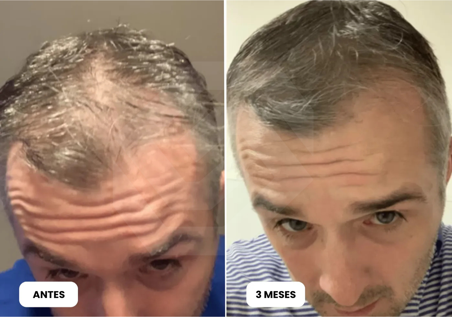 EL PRODUCTO QUE MILES DE PERSONAS USAN PARA CUIDAR SU CABELLO CADA DÍA-HAIR GROWTH SERUM