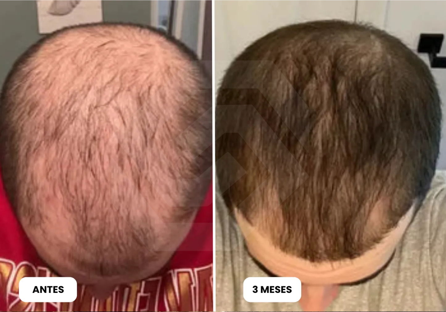 EL PRODUCTO QUE MILES DE PERSONAS USAN PARA CUIDAR SU CABELLO CADA DÍA-HAIR GROWTH SERUM