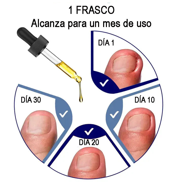 ACEITE ALEMÁN REPARADOR DE UÑAS ToenailPlus™ – FÓRMULA CONTRA HONGOS E INFECCIONES